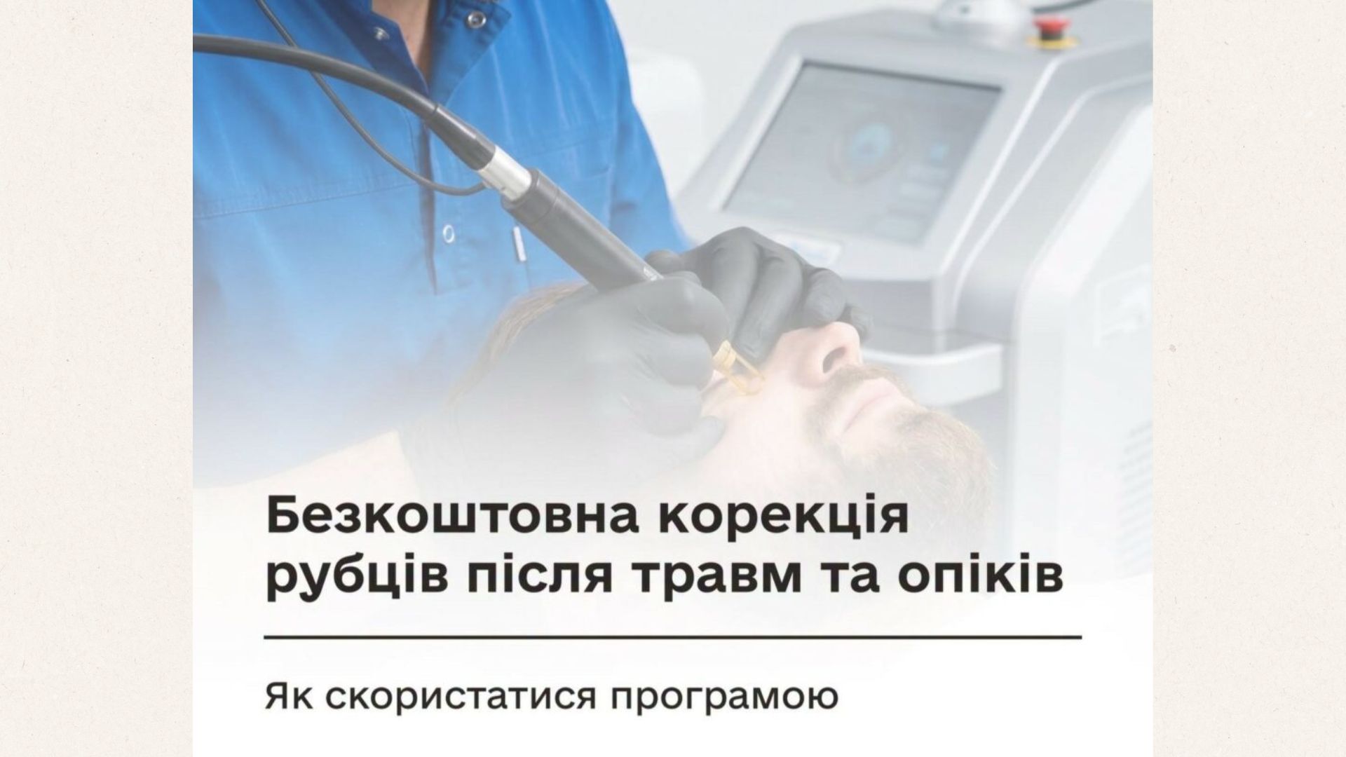Безкоштовна корекція рубців після травм та опіків: як скористатися програмою